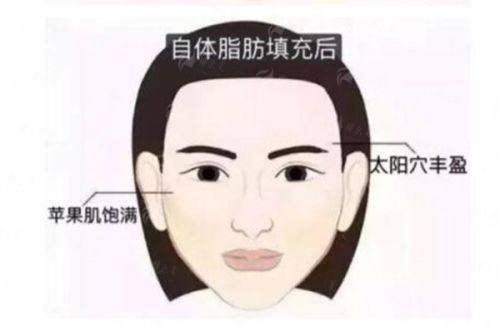 <strong>口碑与真实实例分享：来自求美者的真实评价</strong>