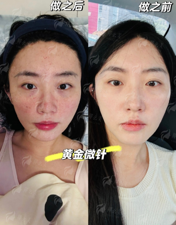 <strong style="color: rgb(255, 0, 0);">从预约到变得更美：在南昌佳美完成轮廓固定的完整流程</strong>