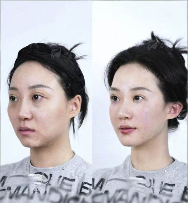 <strong>深度剖析：周国伟医生的特色技术与项目优势</strong>