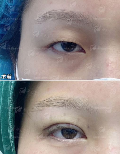 <strong>快速锁定刘正茂医生档期！预约实操指南</strong>