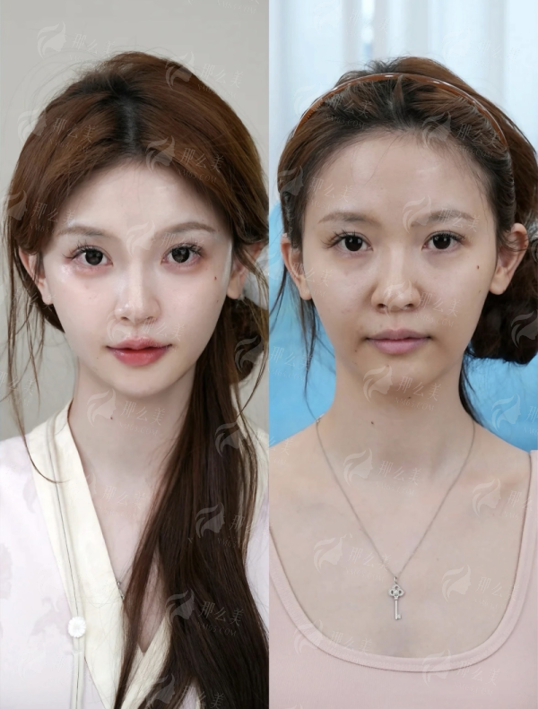 <strong>从预约到修复：南京友谊医院的全程服务与口碑评价</strong>