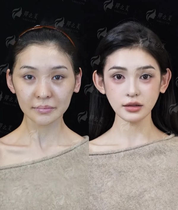 <strong>北京丰联丽格眼修复多少钱？2026年价格区间详解</strong>