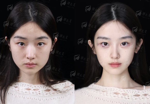 <strong>深入剖析：武汉光泽皇后整形的骨干医生团队实力如何？</strong>