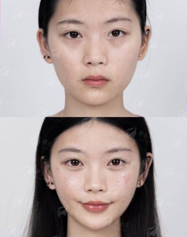 <strong>全方面服务质量与贴心术后护理体系</strong>