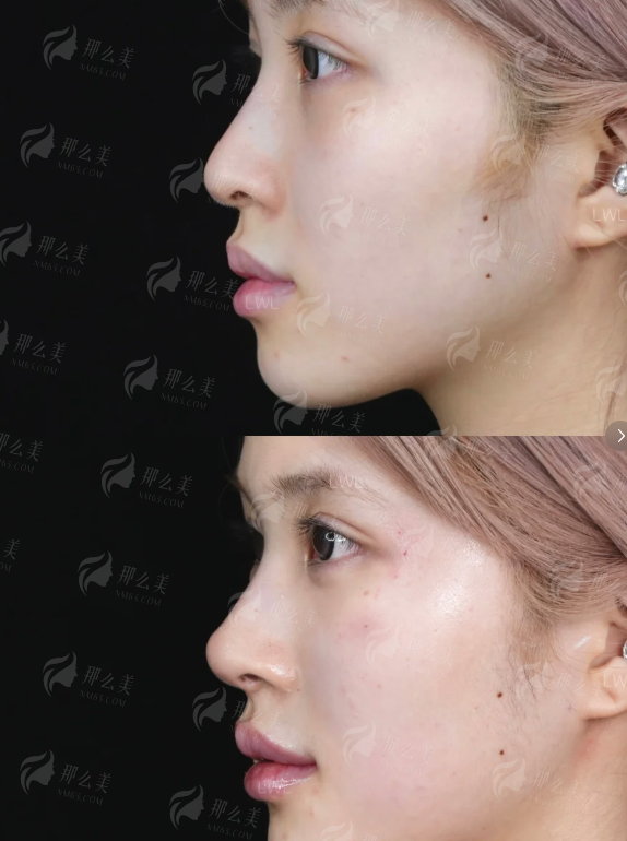 <strong>北京圣嘉新医院口碑与服务：从预约到术后的一站式体验</strong>