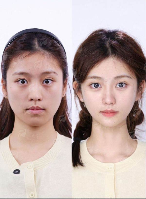 <strong>服务质量与口碑：专精、安心、人性化的求美体验</strong>