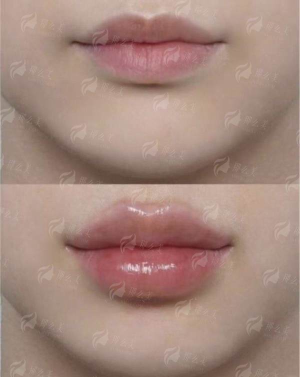 <strong>新颜智尚小程序线上预约面诊！一站式服务指南</strong>