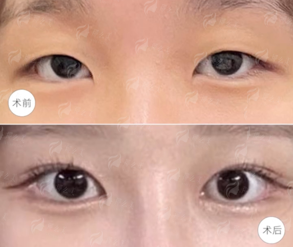 <strong>解析谭新东主事“取奥美定干净”的核心技术优势</strong>