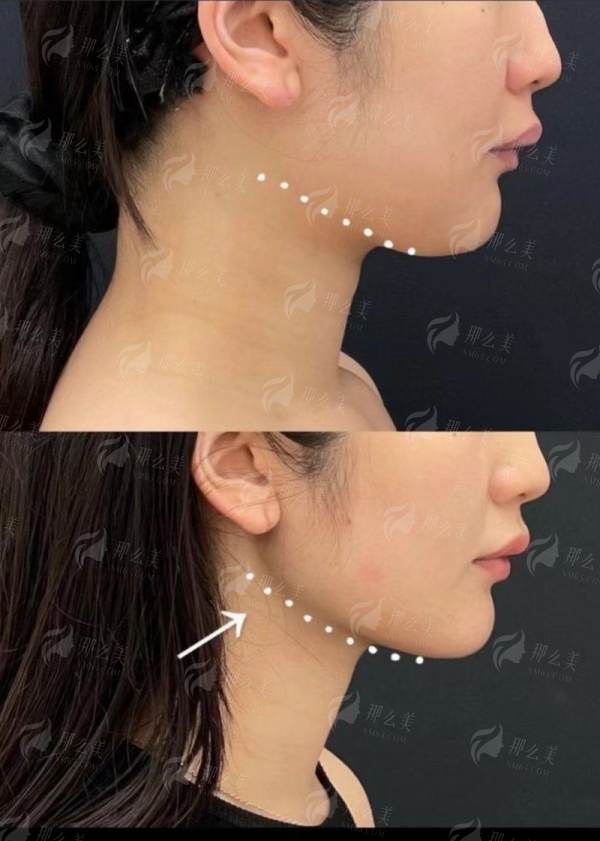 <strong>2026年珠海周国伟医生整形项目价格区间参考</strong>