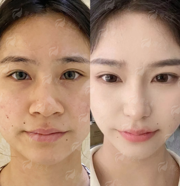 <strong>深圳富华孙占锋医生相关项目价格区间是多少？</strong>