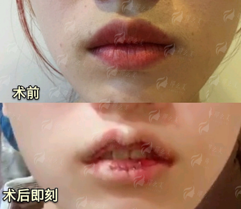 <strong>二、<strong>青岛诺德的马昕医生，擅长解决哪些眼修复难题？</strong></strong>