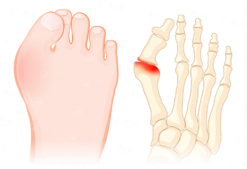 <strong>二、贵阳妍僖整形如何进行植发手术？</strong>