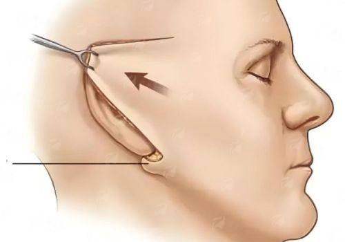 <strong>三、除了<strong>李军平院长</strong>的技术，<strong>湖北襄阳新艾伊尔医疗美容</strong>的整体服务与环境如何？</strong>