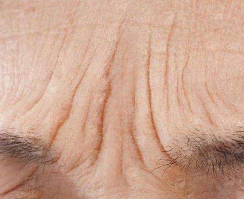 <strong>二、贵阳华医疤痕科的重度妊娠纹修复技术有何特色？</strong>