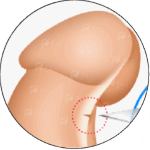 <strong>三、<strong>在天津申伊童颜医疗美容做周海彦院长隆胸，术前术后要注意什么？</strong></strong>