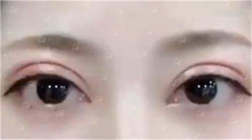 深圳富华唐新辉隆胸技术解析，T11设计法自然和谐，新颜智尚小程序一键预约