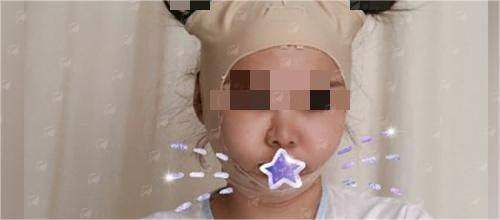 <strong>四、<strong>如何预约深圳安美聚光的彭喜吸脂面诊？</strong></strong>