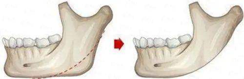 <strong>四、如何效率高预约并开启在上海伯思立的变得更美之旅？</strong>