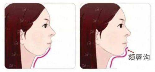 <strong>四、关于<strong>黄学峰富贵包</strong>治疗的更终建议与温馨提示</strong>