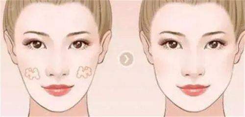 <strong>二、襄阳童颜伊美整形的开眼角价格贵吗？</strong>