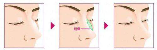 <strong>四、如何预约<strong>李军平院长</strong>在<strong>湖北襄阳新艾伊尔医疗美容</strong>的面诊？多种方式任你选</strong>