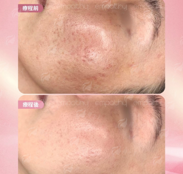 <strong>四、<strong>总结与建议：如何判断罗盛军和长沙星雅是否适合你？</strong></strong>