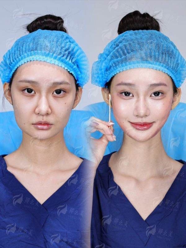 <strong>三、选择广州高尚做“黄金龙隆鼻”有哪些实在优势？</strong>