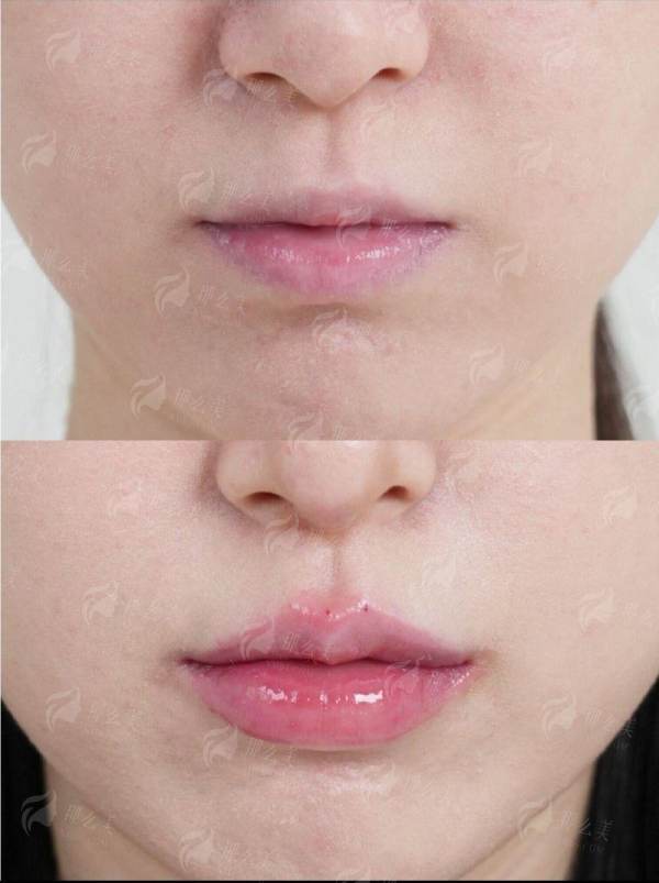 <strong>四、如何预约深圳富华唐新辉院长并了解相关费用？</strong>