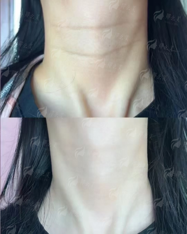 <strong>四、如何选择并预约贵阳华医疤痕科进行重度妊娠纹修复？</strong>