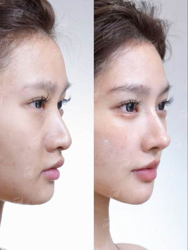 <strong>三、重庆长城骨科医院的颌面整形价格与流程是怎样的？</strong>