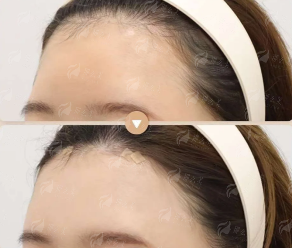 <strong>三、宁波嘉莱美做私密整形靠谱吗？医生与安心深度剖析</strong>