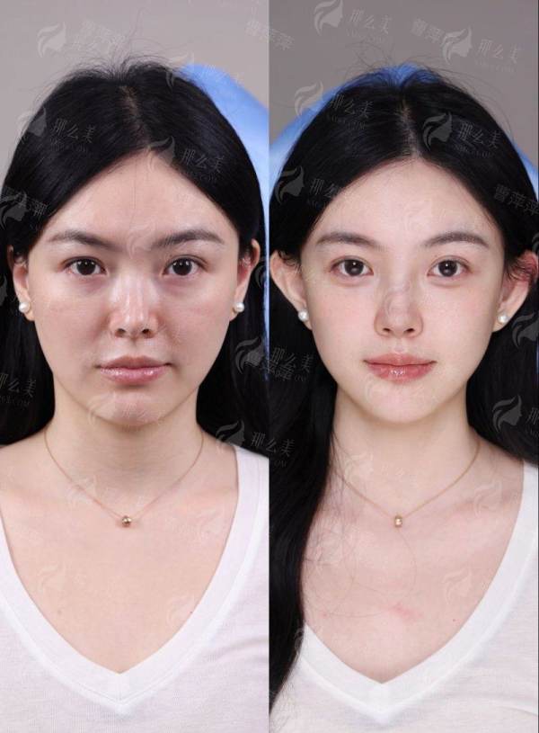 马昕医生在青岛诺德做眼修复技术解析，特色技术与用户反馈，新颜智尚小程序约