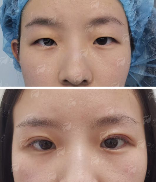 <strong>二、选择像王艳医生这样的骨干医生，为何要重点考察上海伯思立这样的机构？</strong>