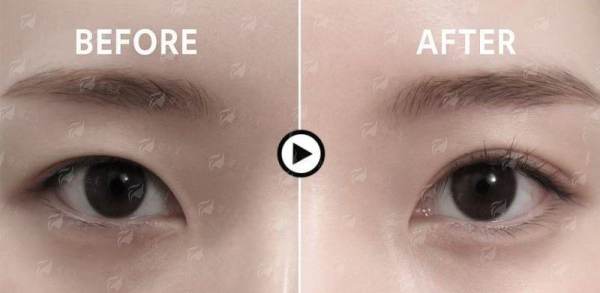 <strong>四、如何预约北京新星靓的宋楠医生面诊？</strong>