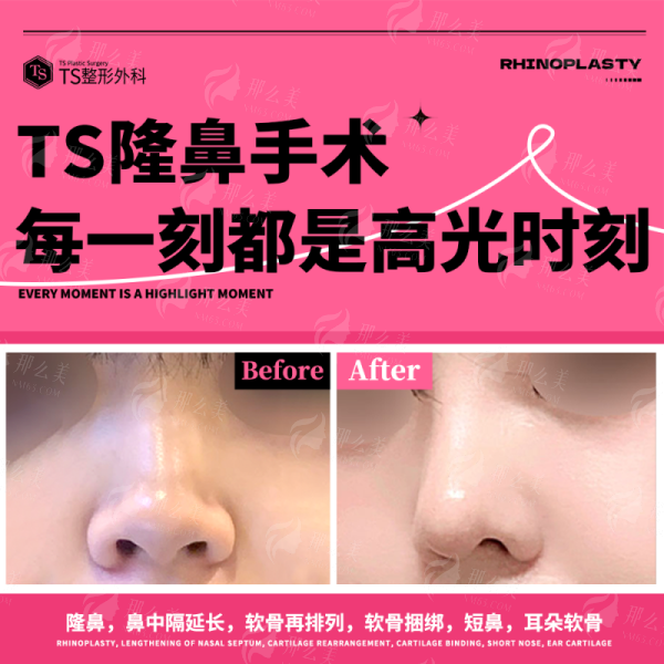 <strong>四、上海联合丽格医疗美容的李鸿君肋骨鼻，值得选择吗？</strong>