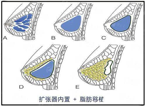 <strong>二、在沈阳选择祛眼袋医院，为何要重点考察及云泽医生所在的杏林整形？</strong>