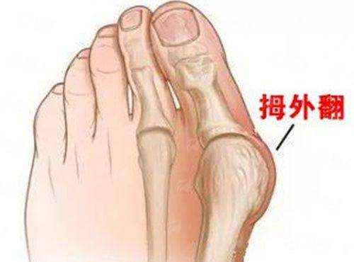 <strong>支波波双眼皮特色技术：不止于一道褶</strong>