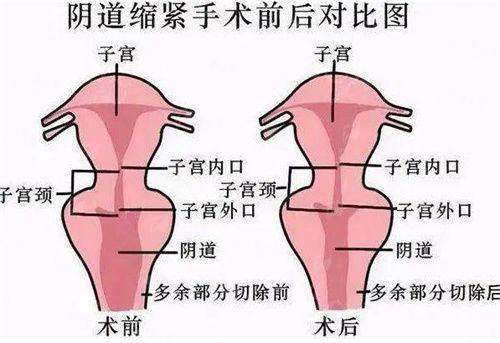 <strong>患者口碑与真实实例看张斌峰植发成效</strong>