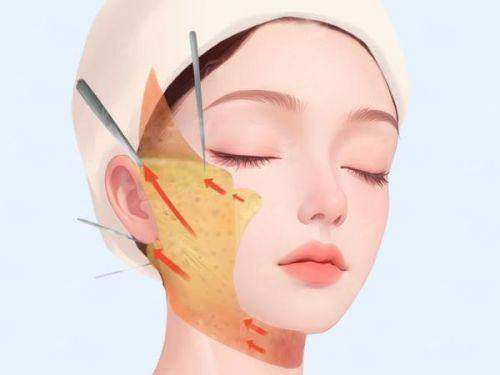 二、新乡弈诺美腰腹环吸医生团队介绍