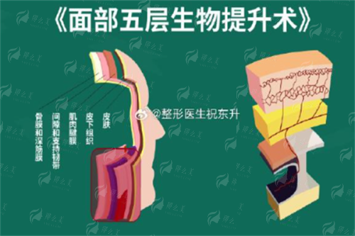 <strong>四、选择运城华美整形门诊部史睿凡医生做光子嫩肤，还需要注意什么？</strong>