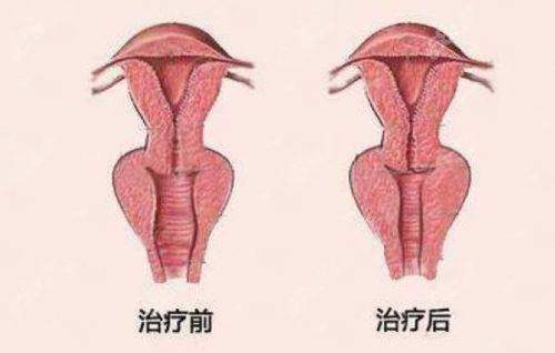 <strong>深圳今喜曹孟君大腿抽脂的骨干医生团队实力如何？</strong>