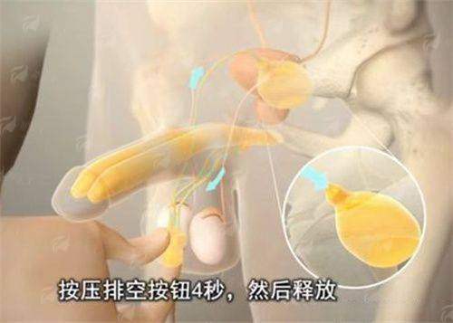 <strong>四、如何预约山东济南艺星整形医院的卢健隆鼻修复？这份指南请收好</strong>