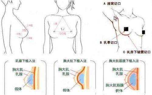 <strong>北京牛大夫植发的服务质量与术后护理体系</strong>
