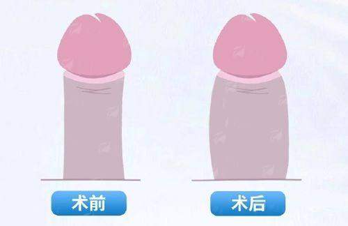 <strong style="color: rgb(255, 0, 0);">成都友谊医院赵延峰做面部轮廓价格贵吗？2026年收费标准参考</strong>