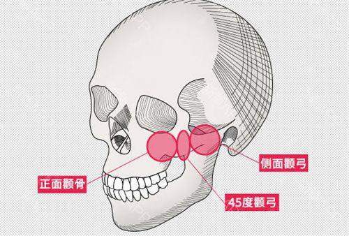 叶豪婕祛斑用户反馈与案例推荐，金华心艺医疗美容新颜智尚小程序一键约