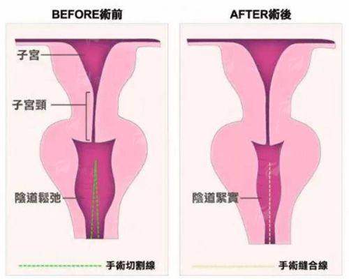 <strong>二、<strong>无锡坤如玛丽整形</strong>的<strong>向文艳鼻部整形</strong>有哪些独特的技术和材料优势？</strong>