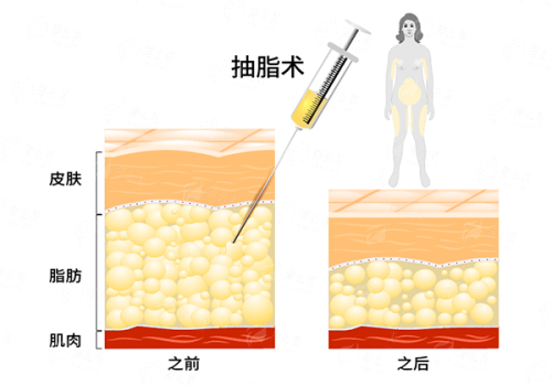 <strong style="color: rgb(255, 0, 0);">林彪斌院长胸部整形预约流程全知道</strong>