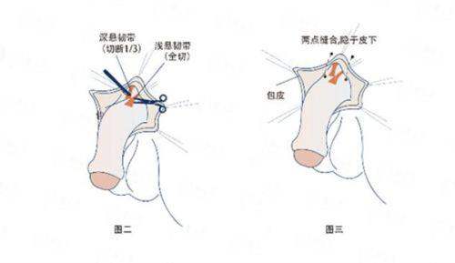 二、珠海雅媛特色面部抗衰项目盘点