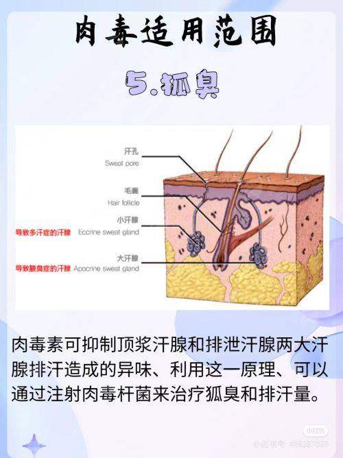 <strong>深度解析：张笑天院长的下颌角截骨核心技术优势</strong>