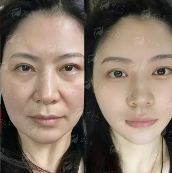 三、真实实例成效对比分析